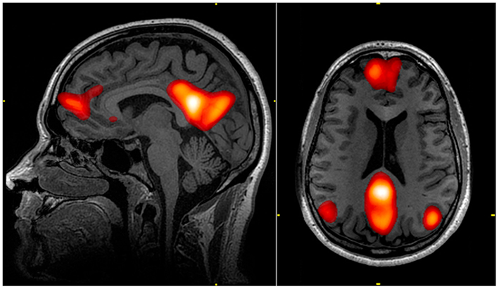 Default Mode Network